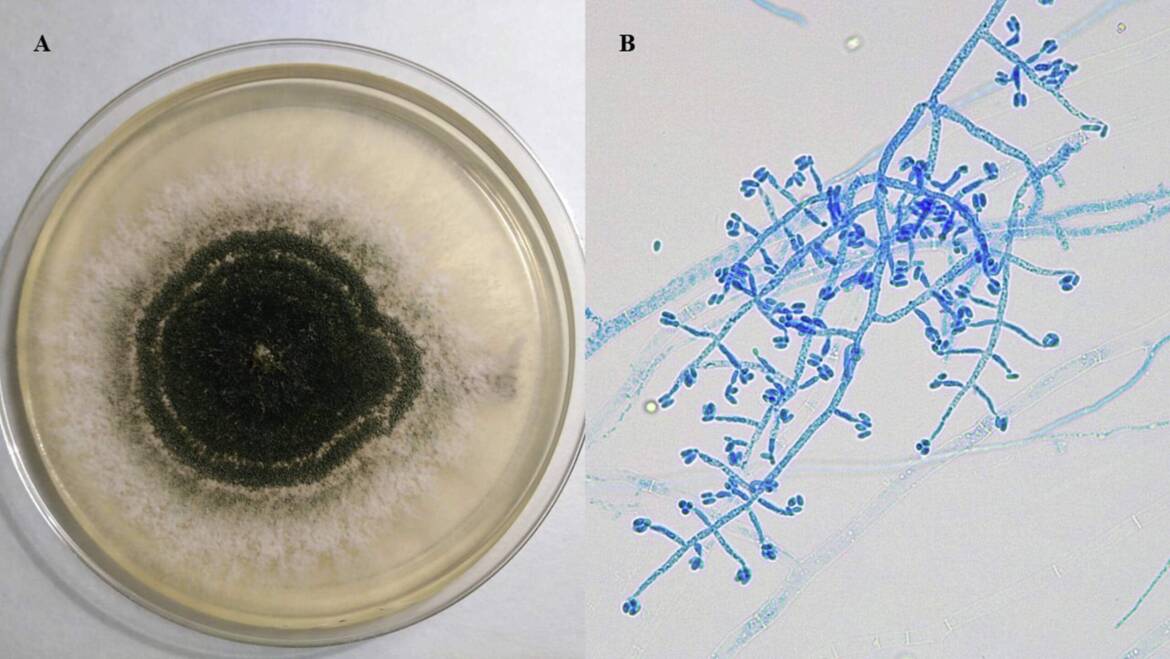 Jak zapobiegać powstawaniu pleśni? Wszystko, co musisz wiedzieć
